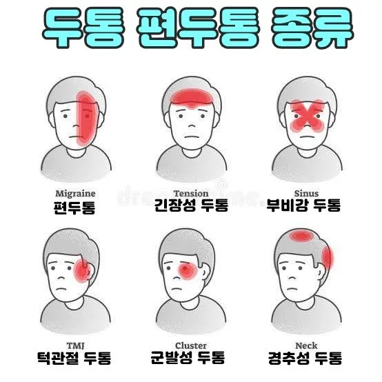 정수리가 아픈 이유와 완화하는 방법_7