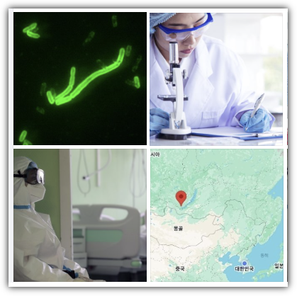 러시아 페스트, 시베리아 방역 연구소 연구원 폐렴 사망, 병원체 유출 의심 사고, 반응, 대응 방안, 관련주 추천, 향후 전망