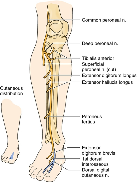 Tibialis anterior 