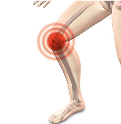 관절영양제-콘드로이친