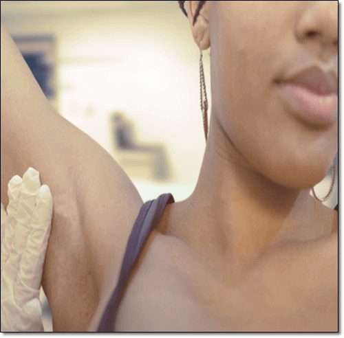 겨드랑이 림프절 부음 검사