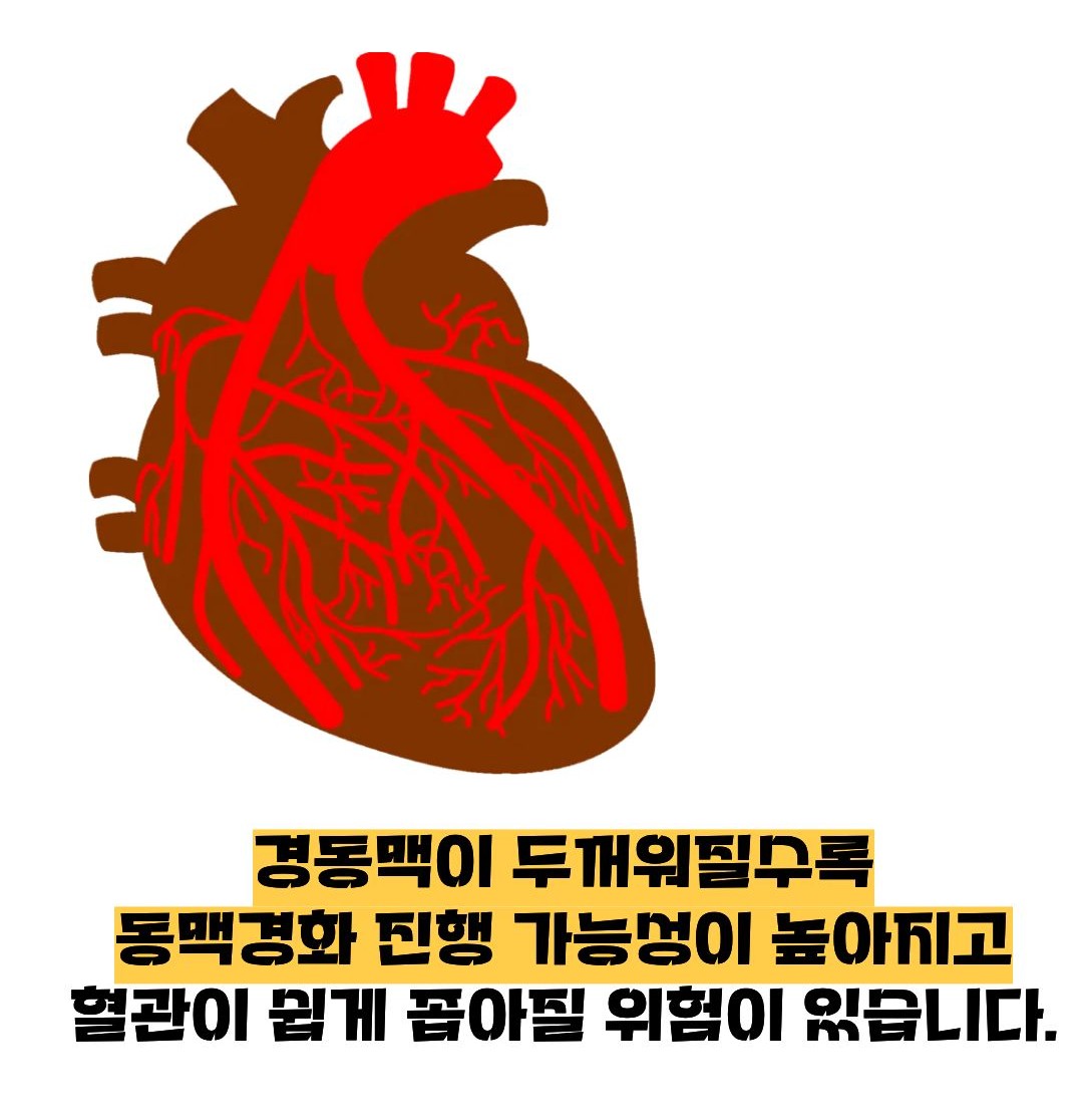 경동맥 두께 정상수치