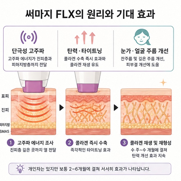 단극성 고주파 에너지가 피부 조직에 열을 전달해 탄력과 타이트닝 및 눈가와 얼굴 주름 개선을 유도하는 원리를 설명한 이미지