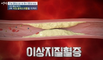 고지혈증
