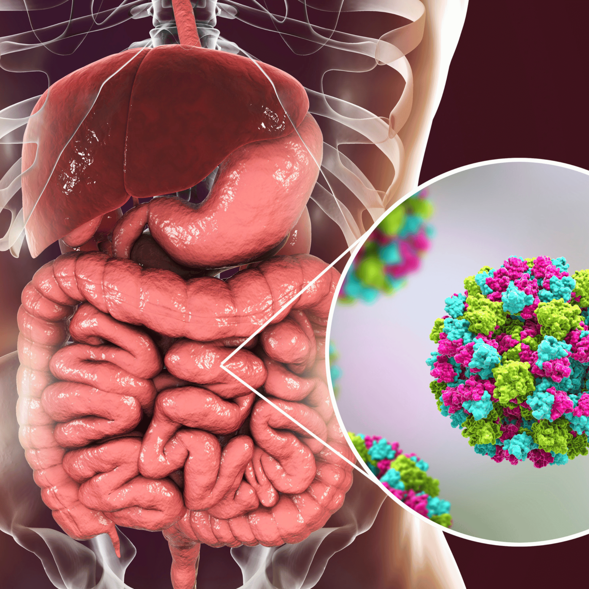 노로바이러스 증상
