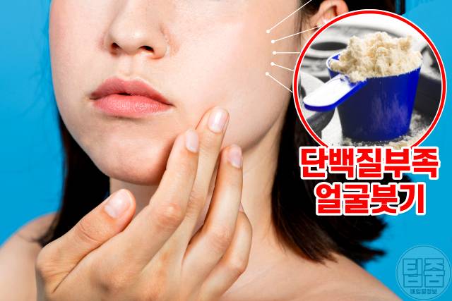 얼굴붓기 빨리 빼는법,얼굴붓기빼는법,얼굴붓기 영양제