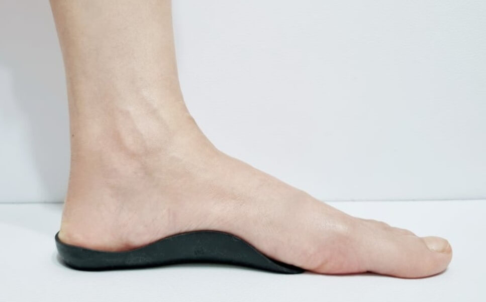 족저 근막염 깔창