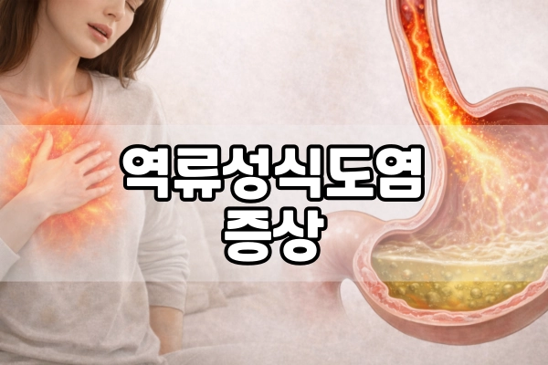 역류성 식도염 증상