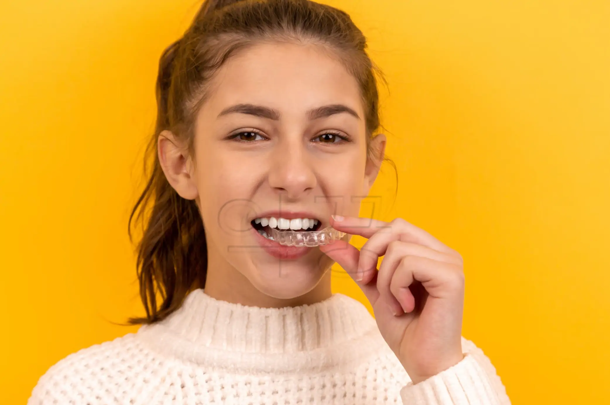 인비절라인 교정 사진