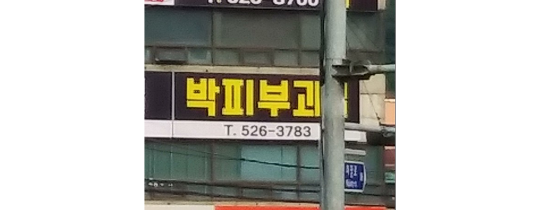 인천 부평구 대상포진