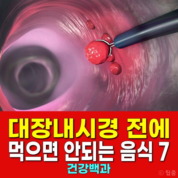 대장내시경 음식
