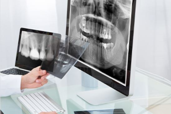 라미네이트-가격-비용