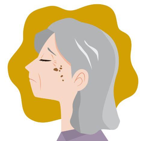 검버섯 없애는 방법