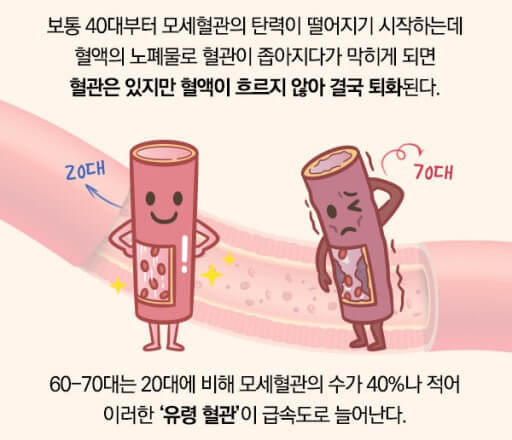 혈관의 노화 돔맥류