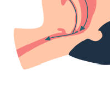 마운자로 효과입증