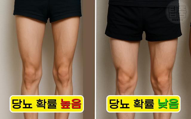 당뇨병 원인 습관 다리 근육량