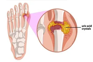 팔꿈치-안쪽-통증