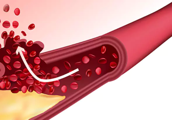 아르기닌-복용법-효능-건강