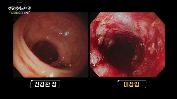 생로병사의 비밀 식이섬유