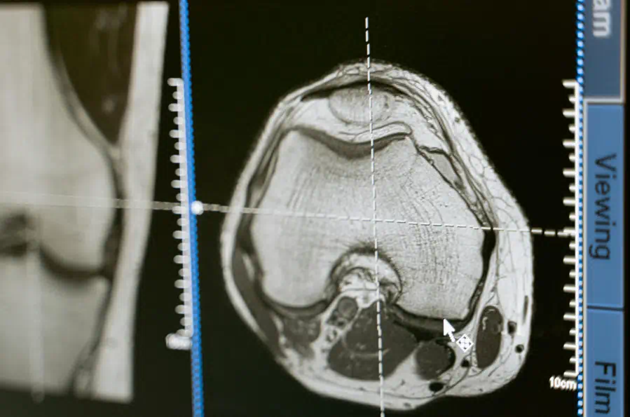 머리 엑스레이 사진을 보고있다
