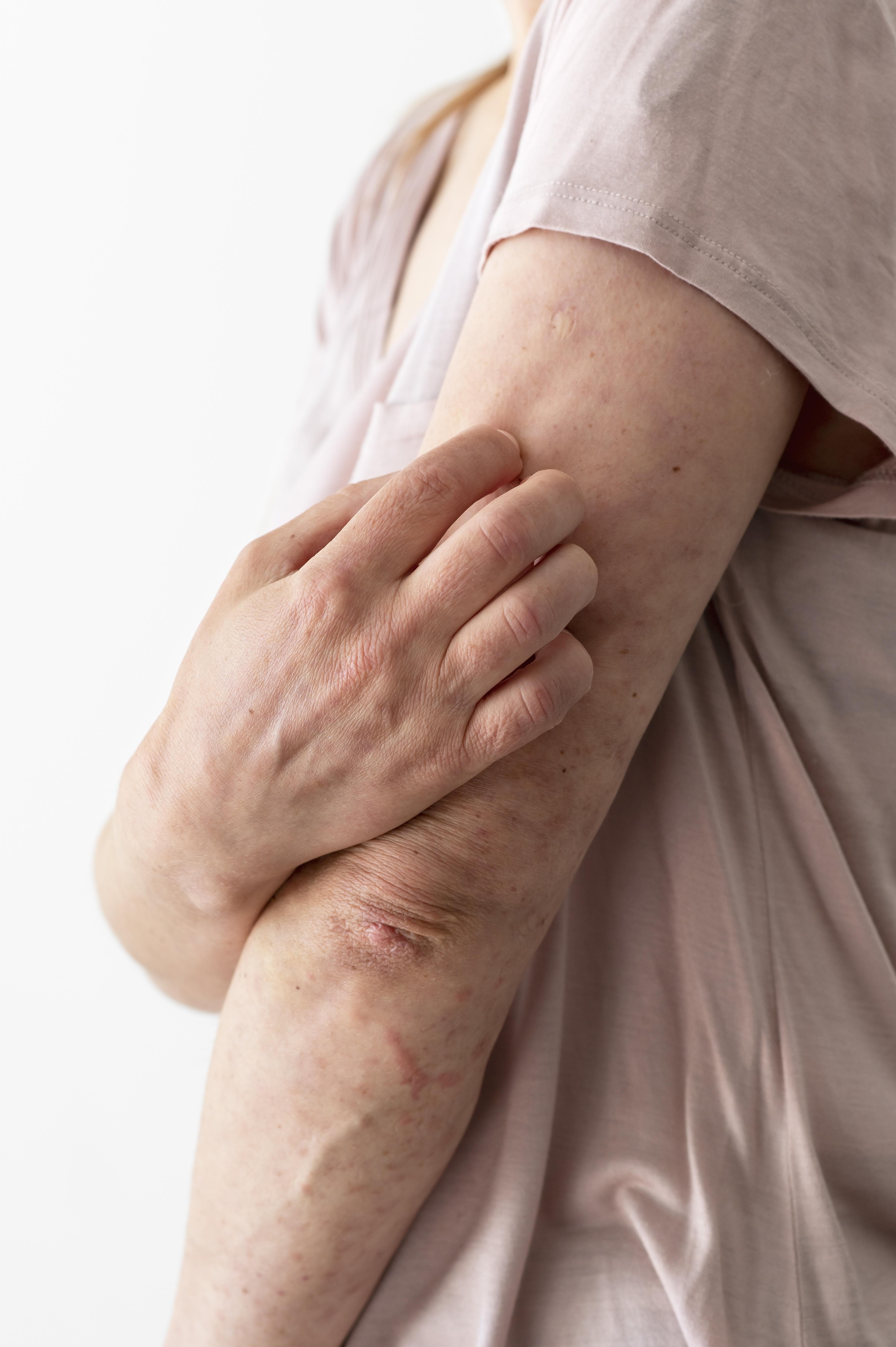 피부 가려움증, 단순 건조일까? 질환일까? 원인별 정확한 구분법