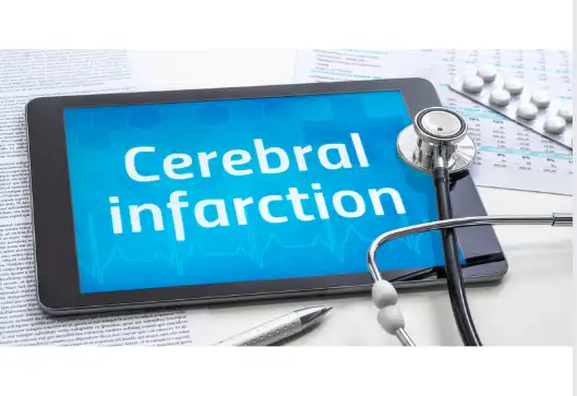 뇌경색 전조증상 및 치료 방법, 좋은 음식 알아보기