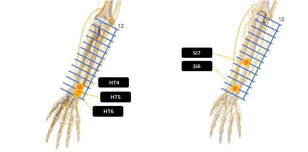 아래팔 전완 주변 혈자리 요약