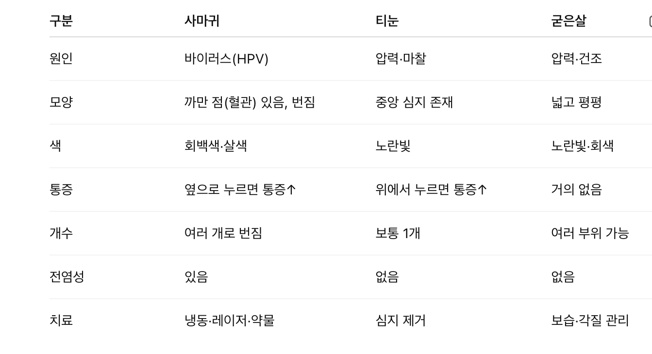 사마귀 vs 티눈 vs 굳은살 비교표