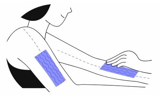 임파선 수술 과정