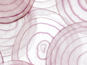 신장에 좋은 음식 나쁜 음식