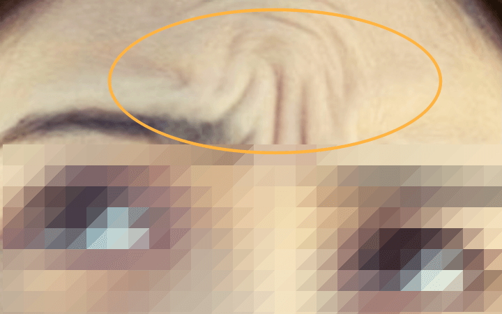 미간의-주름이-심한-여성