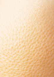 유방암 초기증상