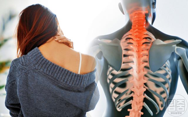 목디스크 증상 자가진단,팁줌