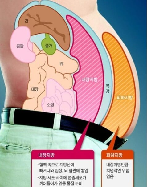 내장 지방 위치와 모습
