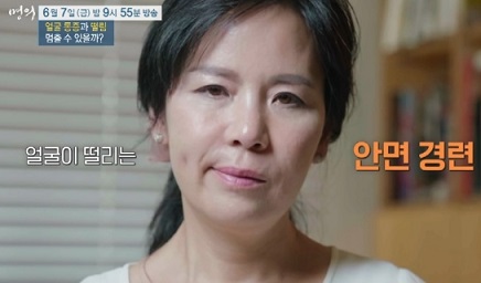 안면경련