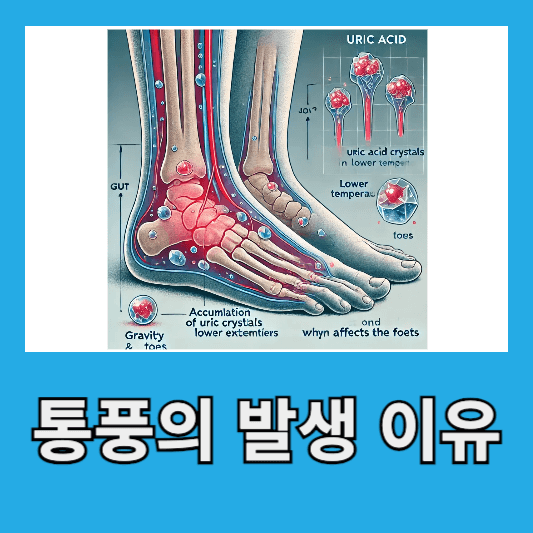 통풍이 발생하는 이유와 관련 부위