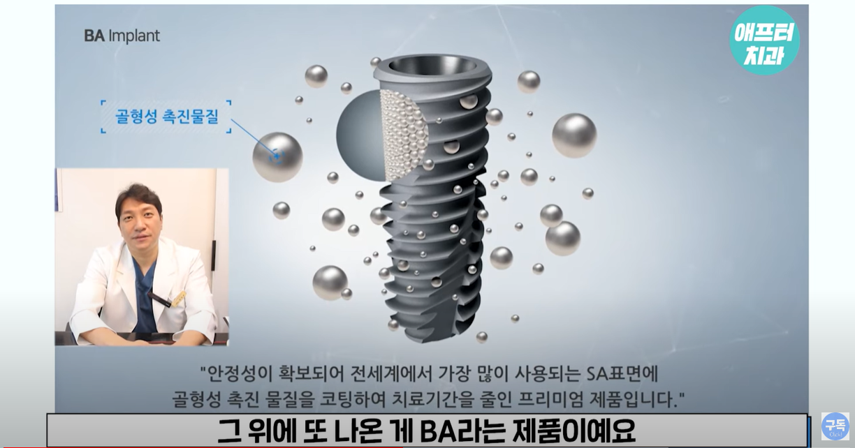 골형성 촉진 물질을 코팅한 제품입니다.