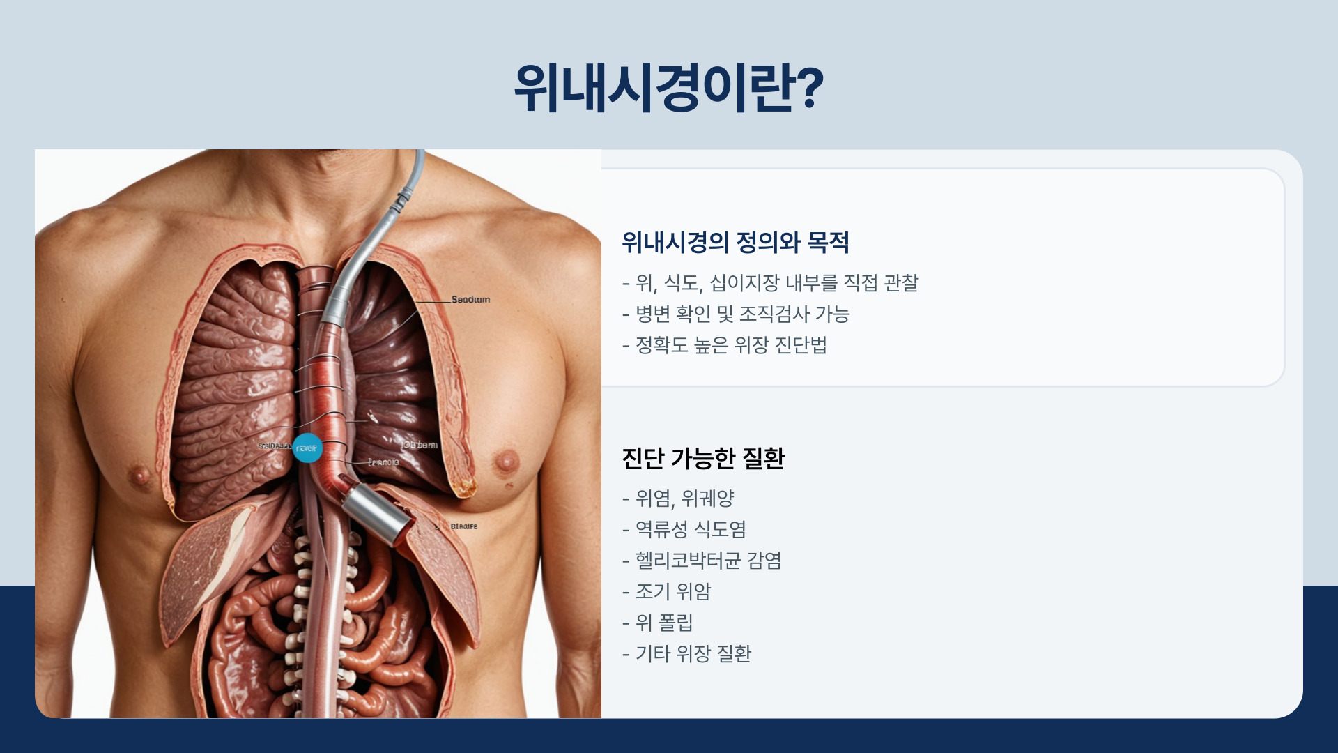 위내시경