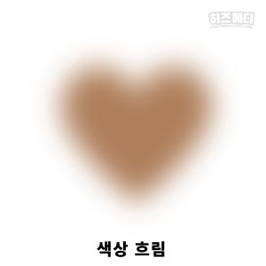 백내장 증상 원인