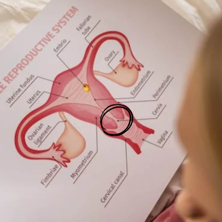 자궁-경부-이미지