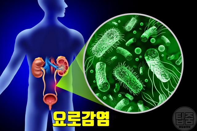요로감염 증상