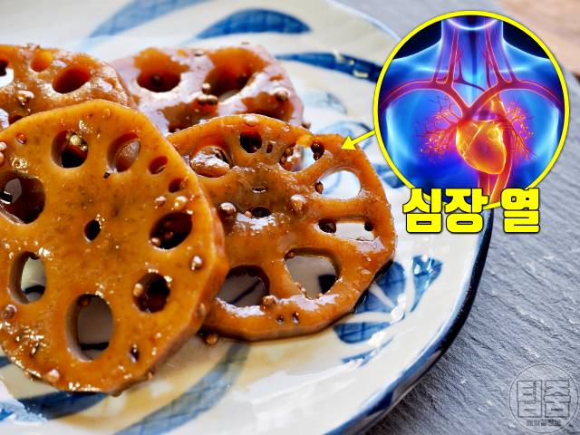 땀에 좋은 음식 땀흘리는데 좋은음식 연근