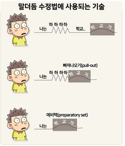 유아말더듬