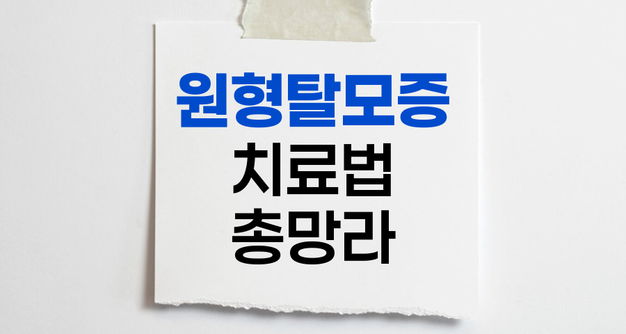 원형탈모증 치료법 총망라