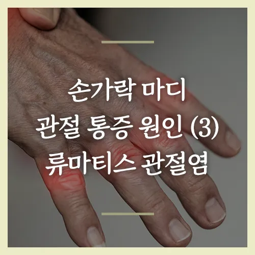 손가락-마디-관절-통증-원인-류마티스-관절염