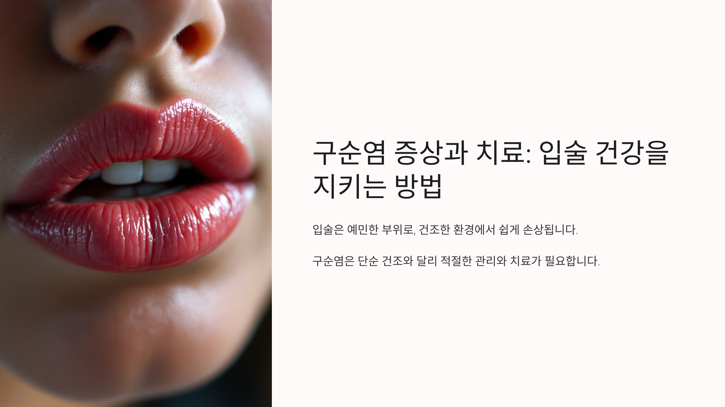 구순염 증상과 치료: 입술 건강을 지키는 방법, 입술 건강, 놓치지 마세요