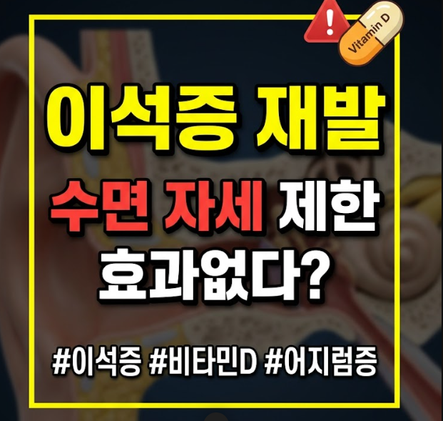 이석증 재발 막는 법