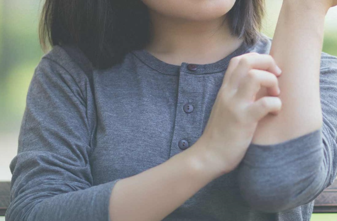 아토피로 인해 몸을 긁는 어린이