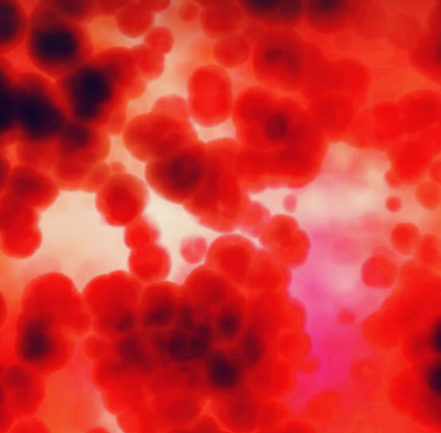 혈액암 증상과 초기증상&amp;#44; 생존율은?