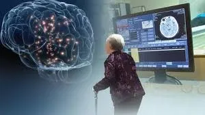 치매 초기증상 8가지